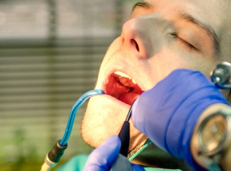 Dental Teeth Scaling A Game Changer For Your Oral Health