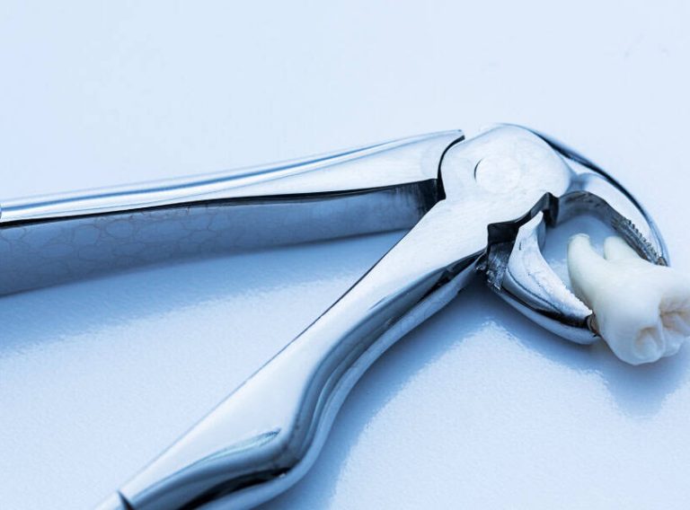 Is Wisdom Teeth Removal Necessary
