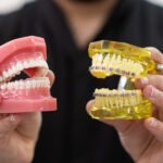 What Is The Invisalign Braces Cost In Mumbai? Find Out Here!