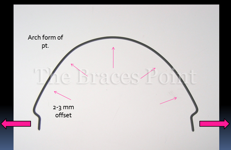 Buccal Expander