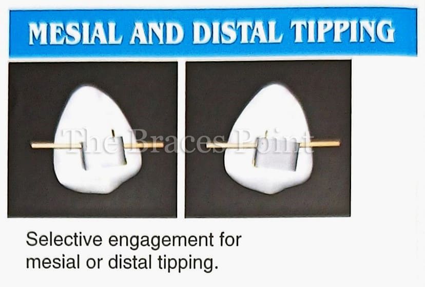 Mesial And Distal Tipping