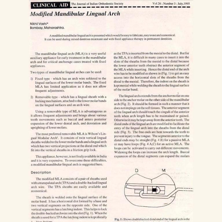 Modified Mandibular Lingual Arch