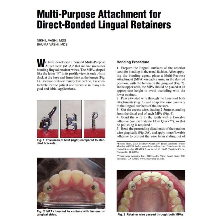 Mpa Bonded Retainer