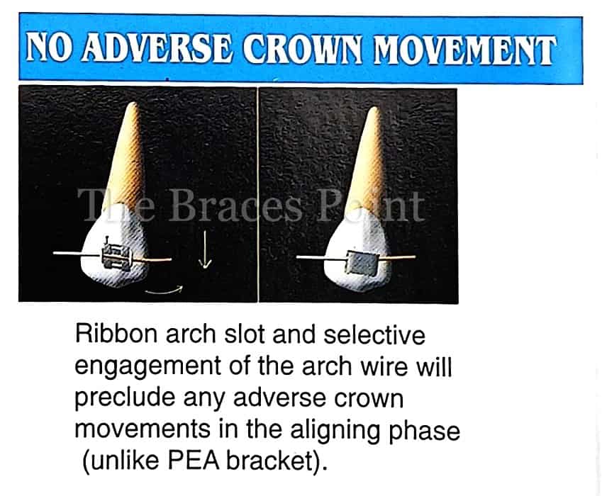 No Adverse Crown Movement