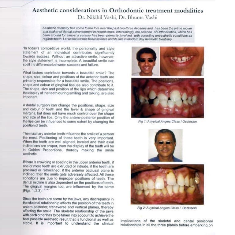 Orthodontics And Aesthetics