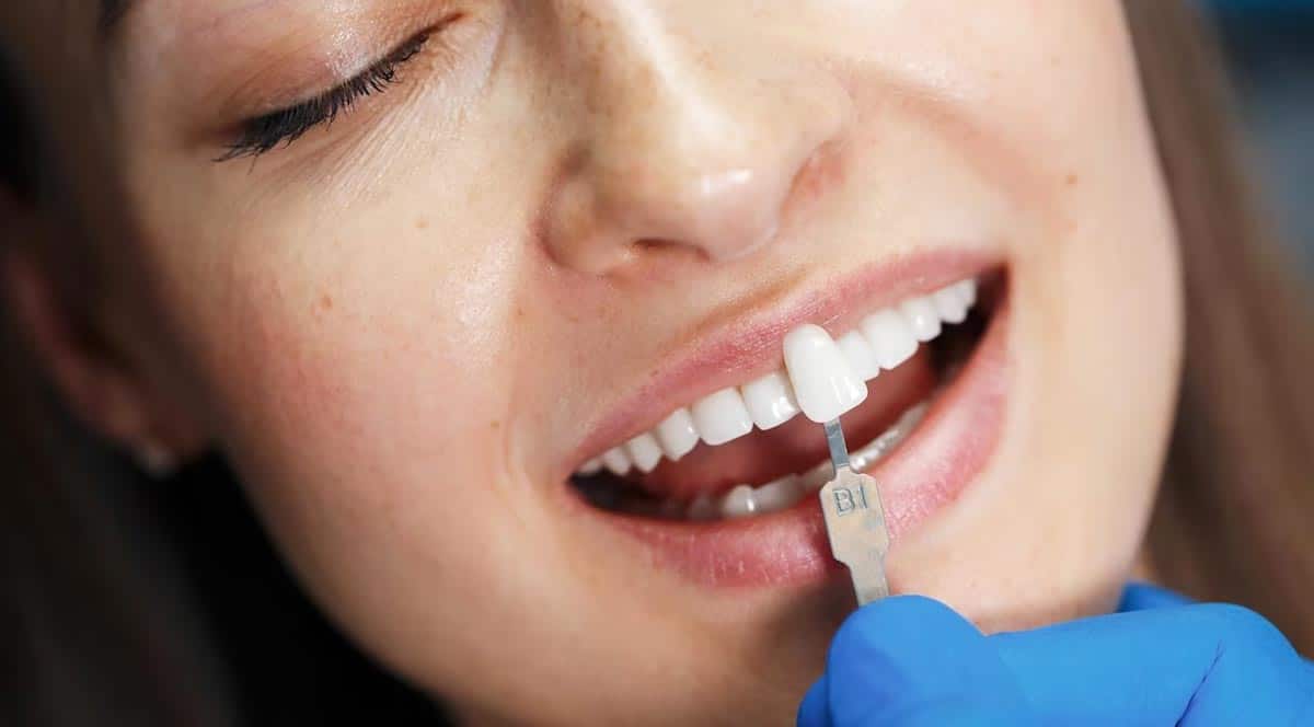 Restoration Of Teeth