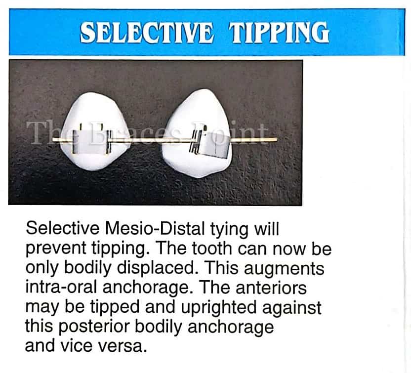 Selective Tipping