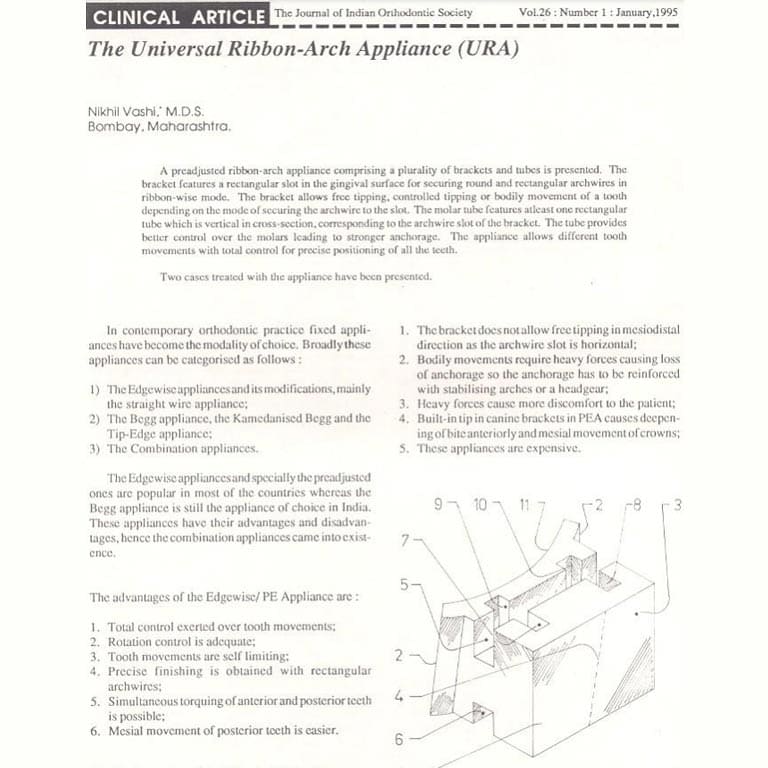 Universal Ribbon Arch Appliance