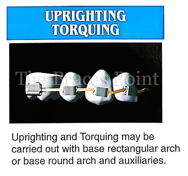 Uprighting Torquing